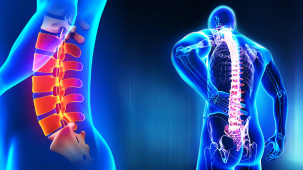 The Evolution Of Laser Spine Treatment