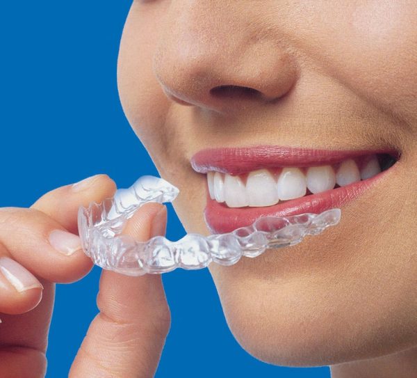 Orthodontic Treatments For Misaligned Teeth